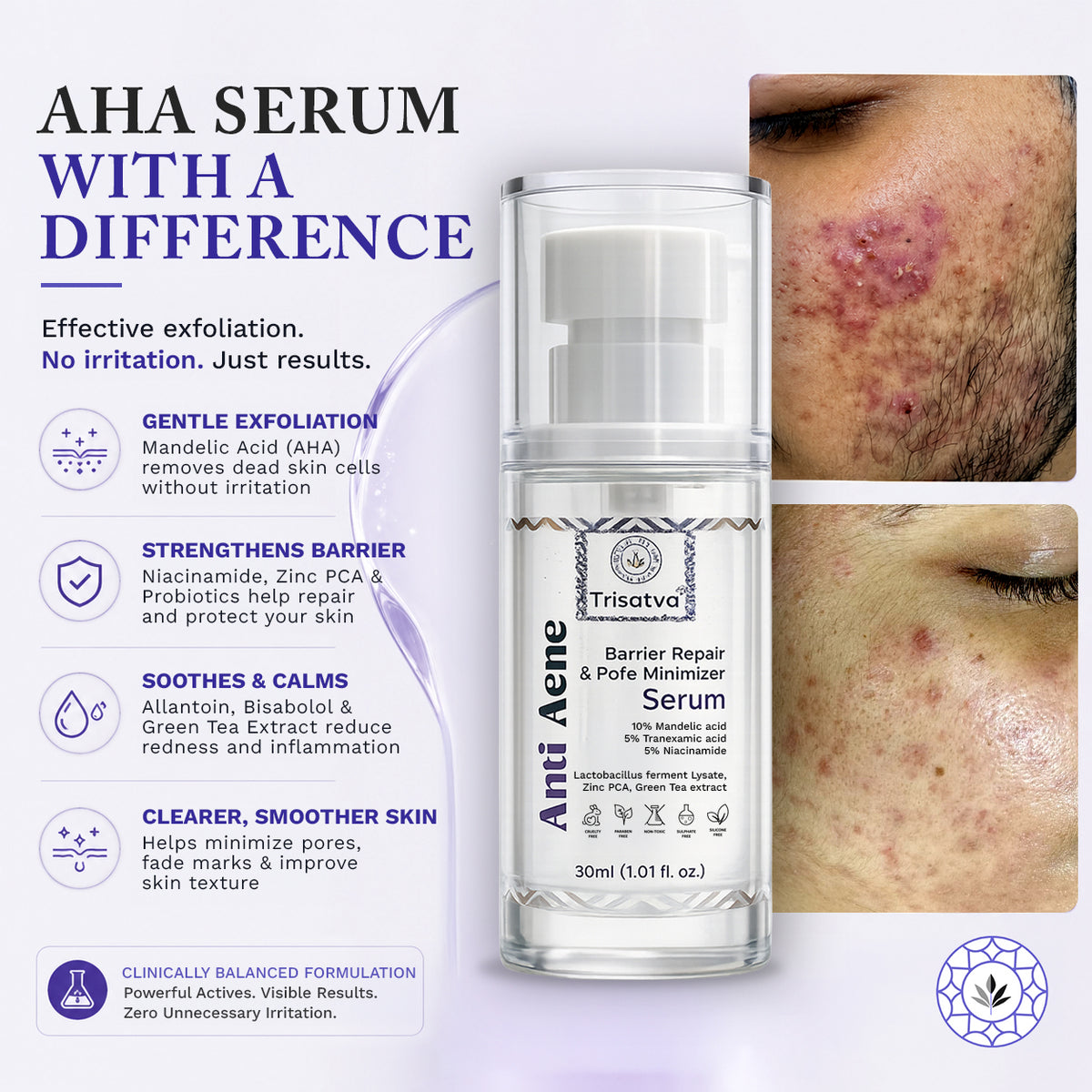 Anti Acne Serum