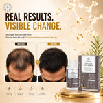 Follé Pro-Densyl Advance Hair Growth Serum