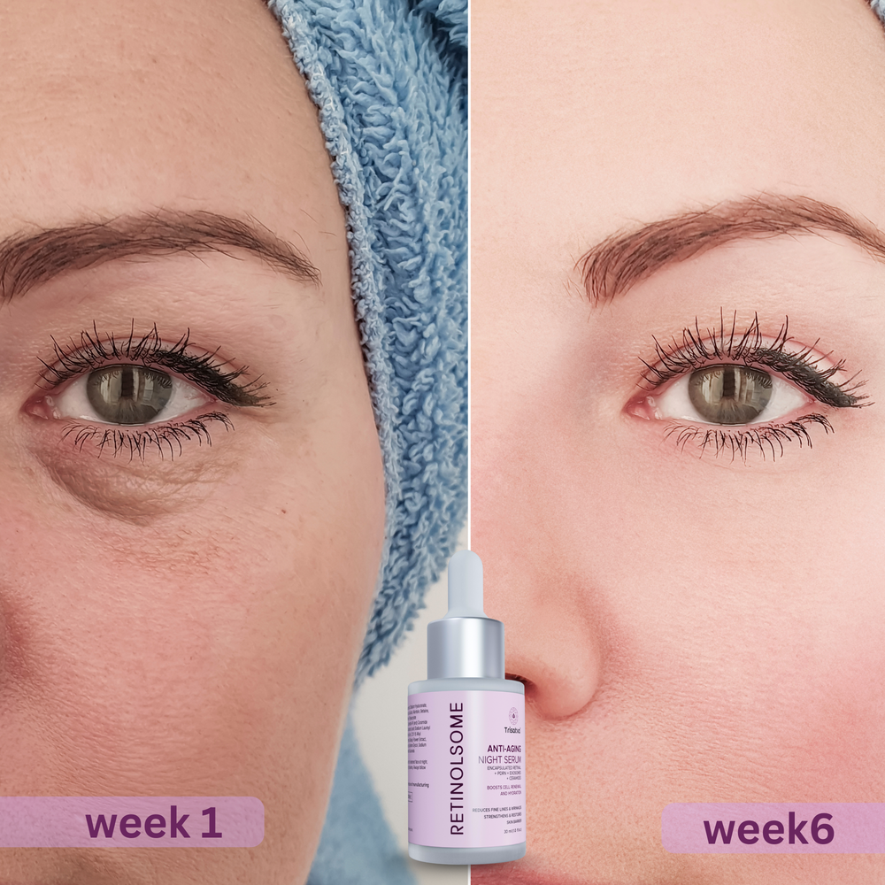 Trisatva India’s First Retinal Shot Serum (Advanced Retinol) with PDRN & Exosomes | Anti Aging Tightening Booster for Glowing Skin | Reduces Wrinkles & Fine Lines (30ml)