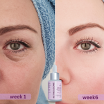 Trisatva India’s First Retinal Shot Serum (Advanced Retinol) with PDRN & Exosomes | Anti Aging Tightening Booster for Glowing Skin | Reduces Wrinkles & Fine Lines (30ml)