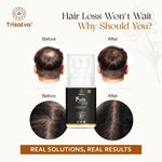Trisatva Folle Pro-Densyl Hair Serum